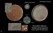 haemophilus influenzae
